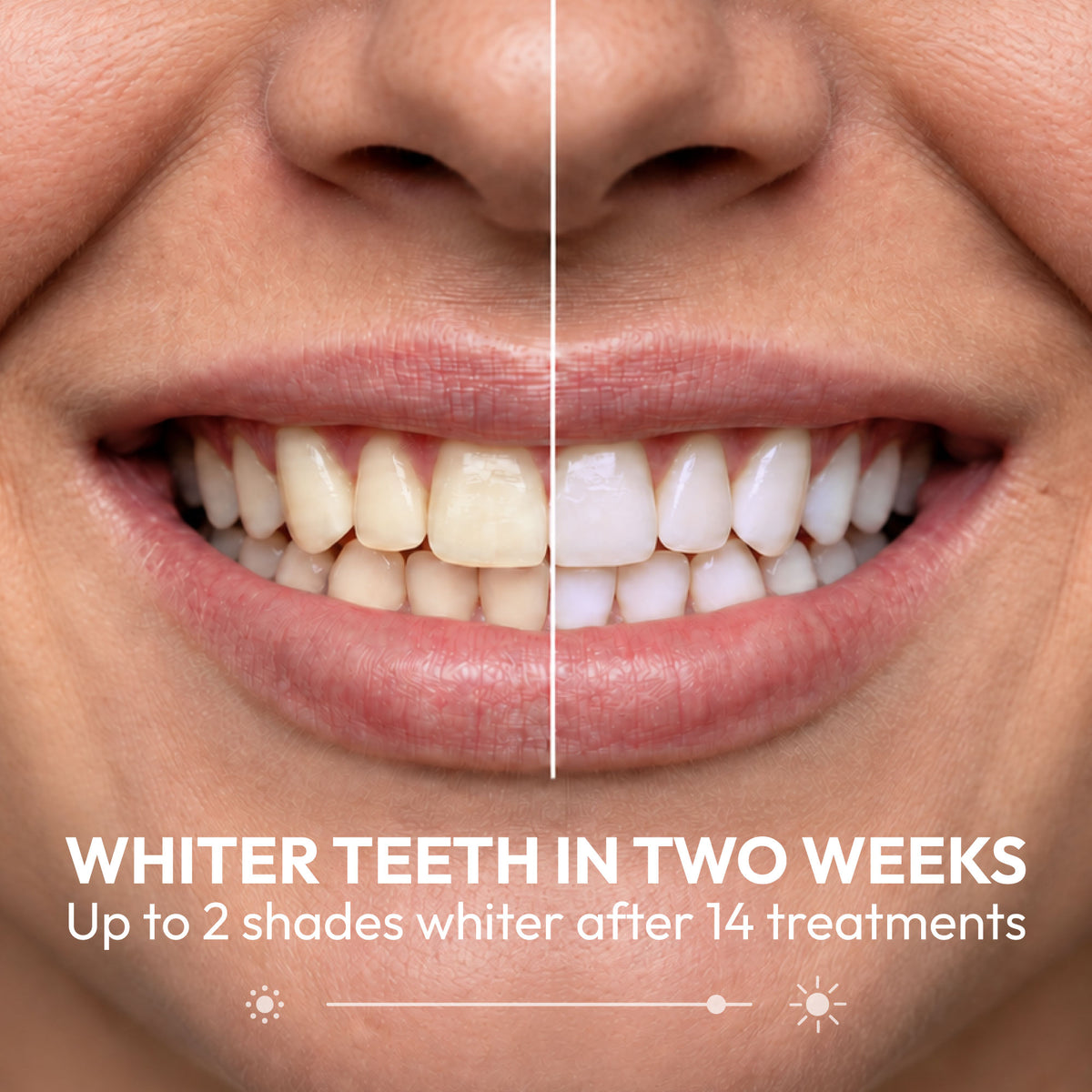 Teeth Whitening Strips (14 pack)